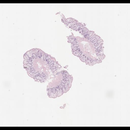  NCBI Organism:Homo sapiens, ; Biological process:;