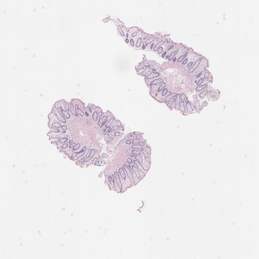  NCBI Organism:Homo sapiens, ; Biological process:;