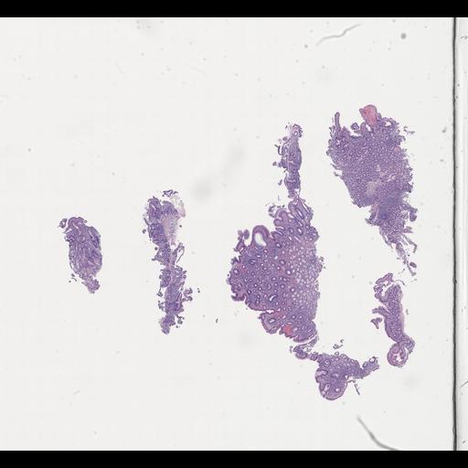  NCBI Organism:Homo sapiens, ; Biological process:;