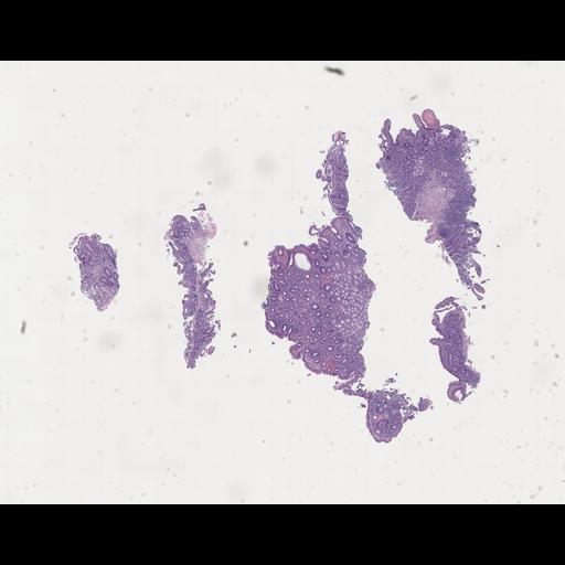  NCBI Organism:Homo sapiens, ; Biological process:;