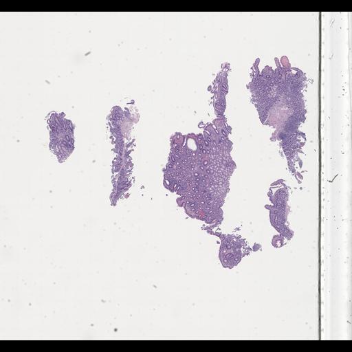  NCBI Organism:Homo sapiens, ; Biological process:;