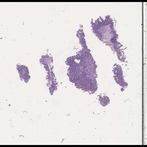  NCBI Organism:Homo sapiens, ; Biological process:;