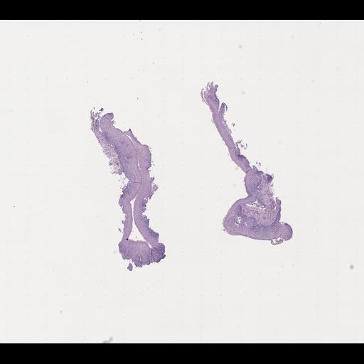  NCBI Organism:Homo sapiens, ; Biological process:;