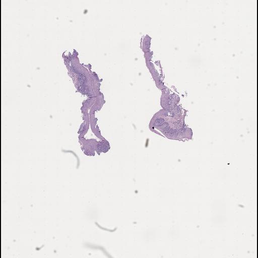  NCBI Organism:Homo sapiens, ; Biological process:;