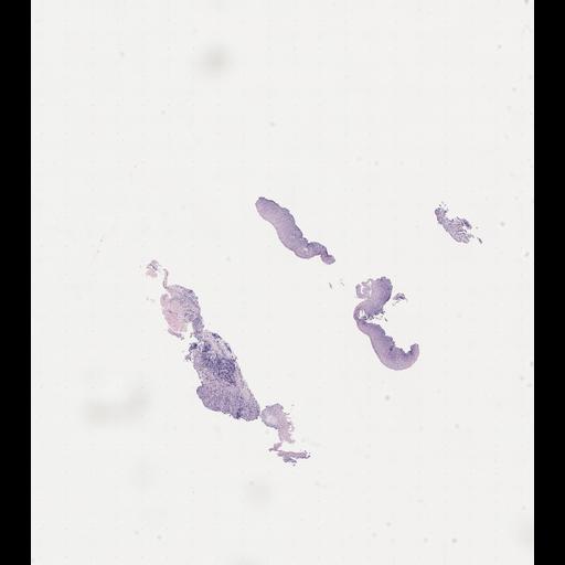  NCBI Organism:Homo sapiens, ; Biological process:;