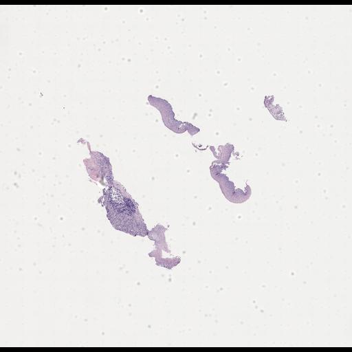  NCBI Organism:Homo sapiens, ; Biological process:;