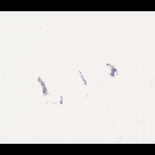  NCBI Organism:Homo sapiens, ; Biological process:;