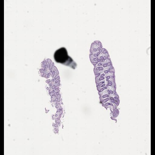  NCBI Organism:Homo sapiens, ; Biological process:;