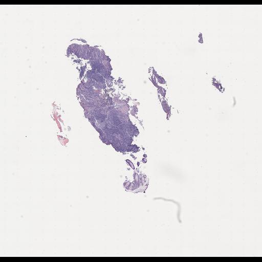  NCBI Organism:Homo sapiens, ; Biological process:;