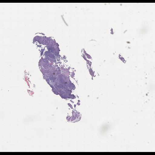  NCBI Organism:Homo sapiens, ; Biological process:;