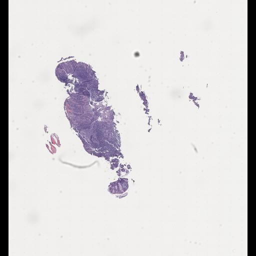  NCBI Organism:Homo sapiens, ; Biological process:;