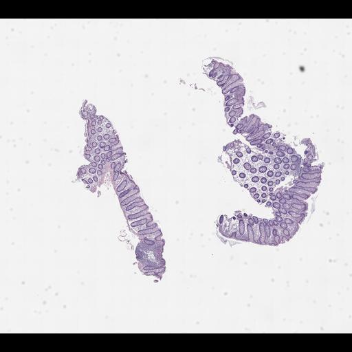  NCBI Organism:Homo sapiens, ; Biological process:;