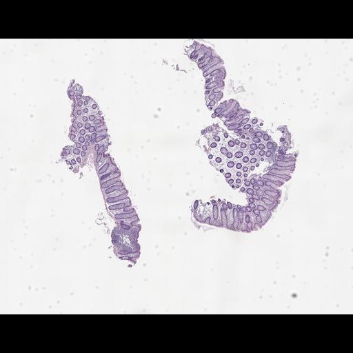  NCBI Organism:Homo sapiens, ; Biological process:;