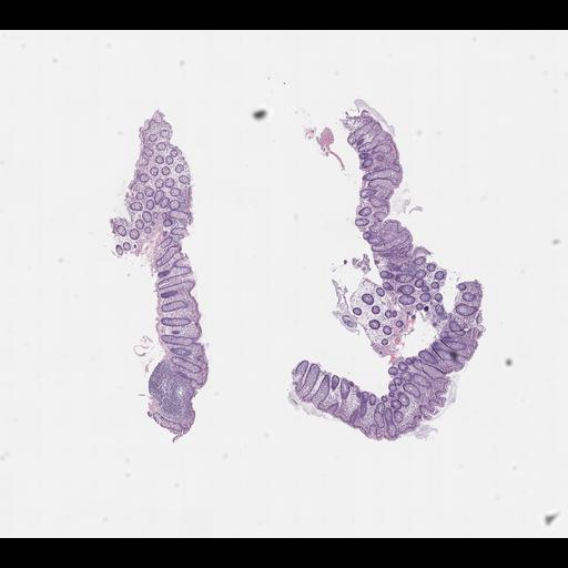  NCBI Organism:Homo sapiens, ; Biological process:;