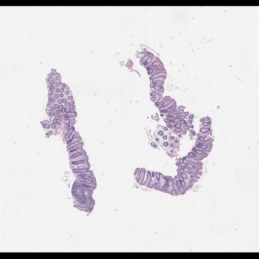  NCBI Organism:Homo sapiens, ; Biological process:;