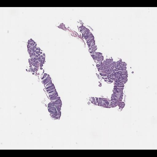  NCBI Organism:Homo sapiens, ; Biological process:;