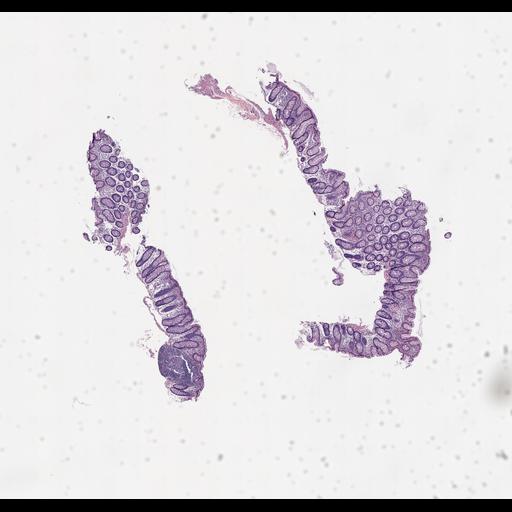  NCBI Organism:Homo sapiens, ; Biological process:;