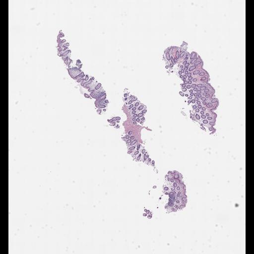  NCBI Organism:Homo sapiens, ; Biological process:;