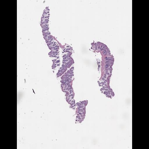  NCBI Organism:Homo sapiens, ; Biological process:;