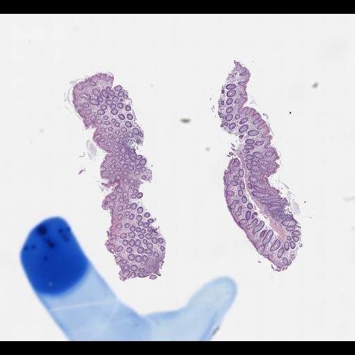  NCBI Organism:Homo sapiens, ; Biological process:;