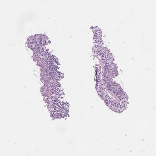  NCBI Organism:Homo sapiens, ; Biological process:;