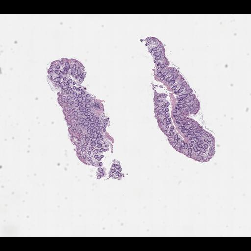  NCBI Organism:Homo sapiens, ; Biological process:;