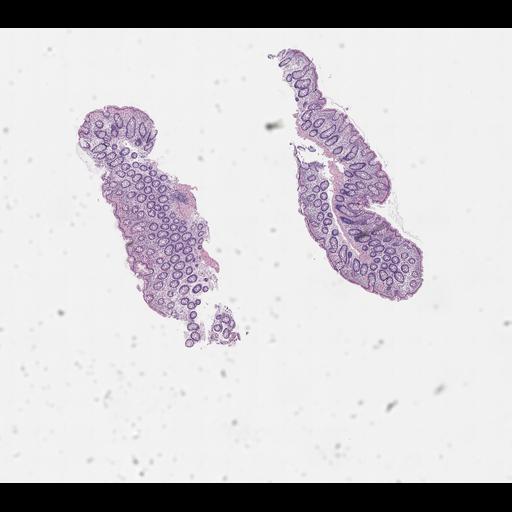  NCBI Organism:Homo sapiens, ; Biological process:;