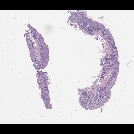  NCBI Organism:Homo sapiens, ; Biological process:;