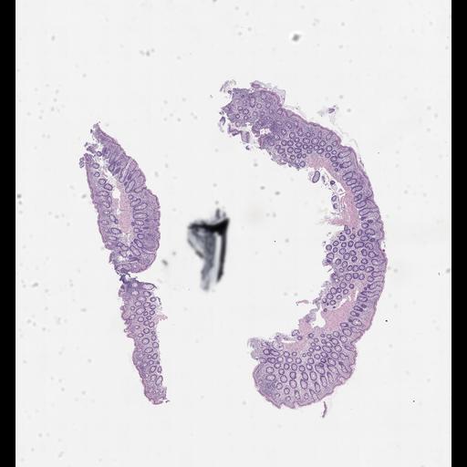  NCBI Organism:Homo sapiens, ; Biological process:;