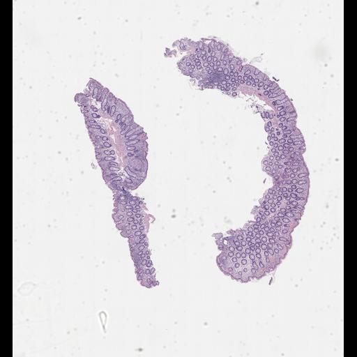  NCBI Organism:Homo sapiens, ; Biological process:;