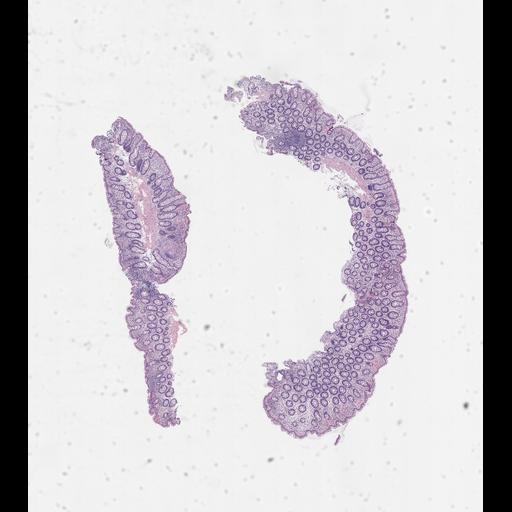  NCBI Organism:Homo sapiens, ; Biological process:;