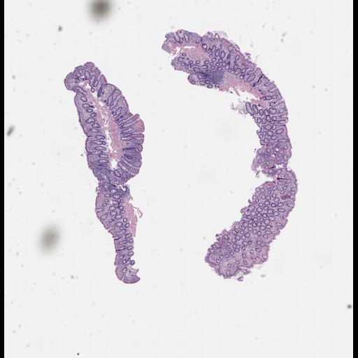  NCBI Organism:Homo sapiens, ; Biological process:;