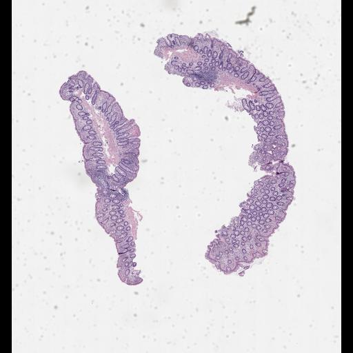  NCBI Organism:Homo sapiens, ; Biological process:;