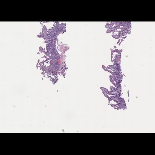  NCBI Organism:Homo sapiens, ; Biological process:;