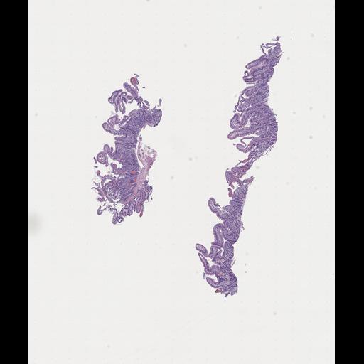  NCBI Organism:Homo sapiens, ; Biological process:;