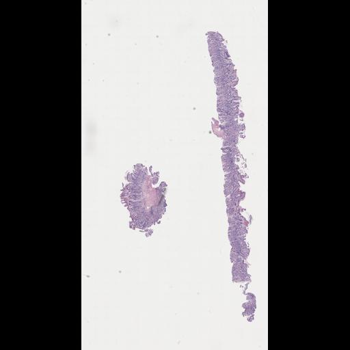  NCBI Organism:Homo sapiens, ; Biological process:;