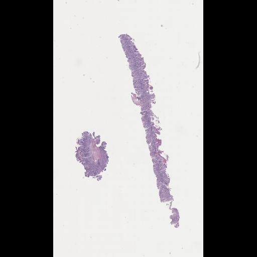  NCBI Organism:Homo sapiens, ; Biological process:;