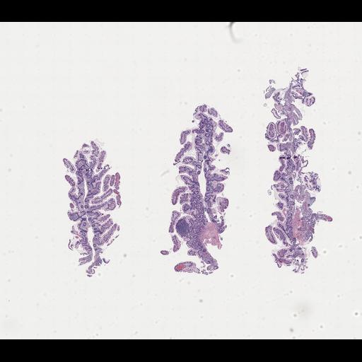  NCBI Organism:Homo sapiens, ; Biological process:;