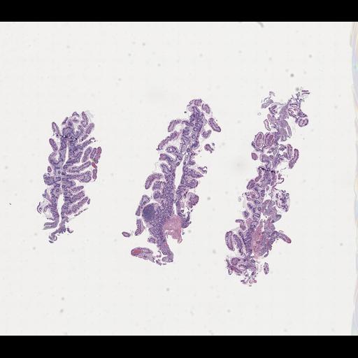  NCBI Organism:Homo sapiens, ; Biological process:;