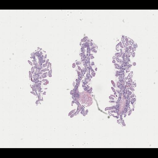  NCBI Organism:Homo sapiens, ; Biological process:;