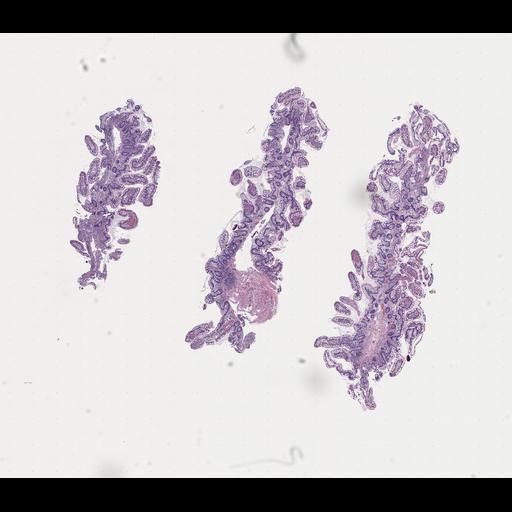  NCBI Organism:Homo sapiens, ; Biological process:;