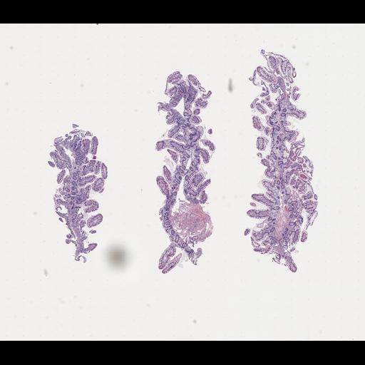  NCBI Organism:Homo sapiens, ; Biological process:;