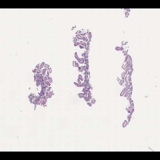  NCBI Organism:Homo sapiens, ; Biological process:;