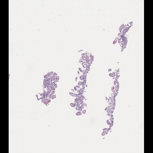  NCBI Organism:Homo sapiens, ; Biological process:;