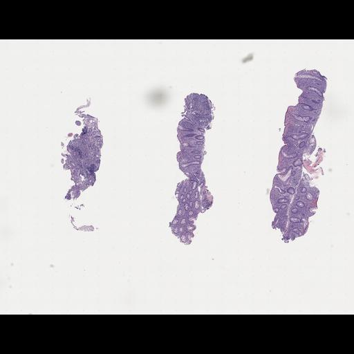  NCBI Organism:Homo sapiens, ; Biological process:;