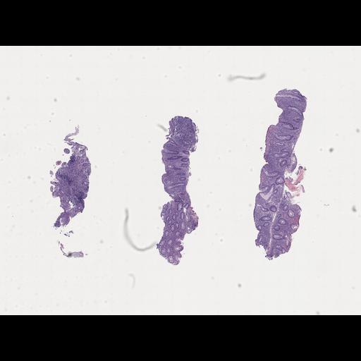  NCBI Organism:Homo sapiens, ; Biological process:;