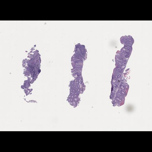  NCBI Organism:Homo sapiens, ; Biological process:;