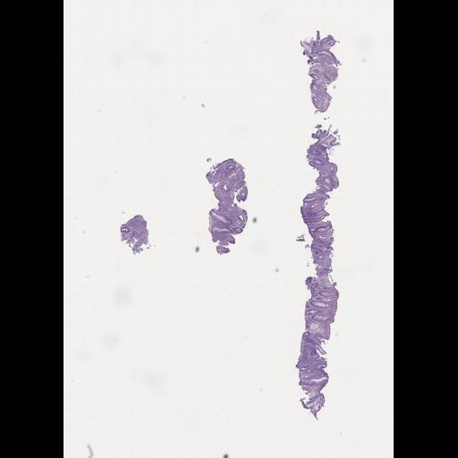  NCBI Organism:Homo sapiens, ; Biological process:;