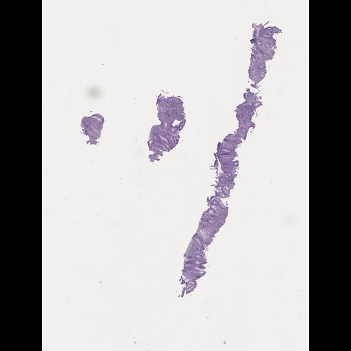  NCBI Organism:Homo sapiens, ; Biological process:;