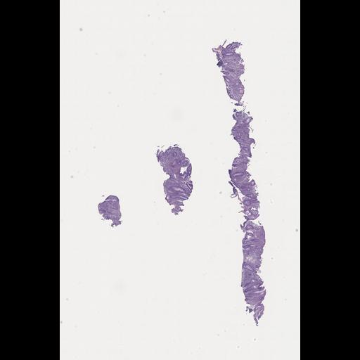  NCBI Organism:Homo sapiens, ; Biological process:;
